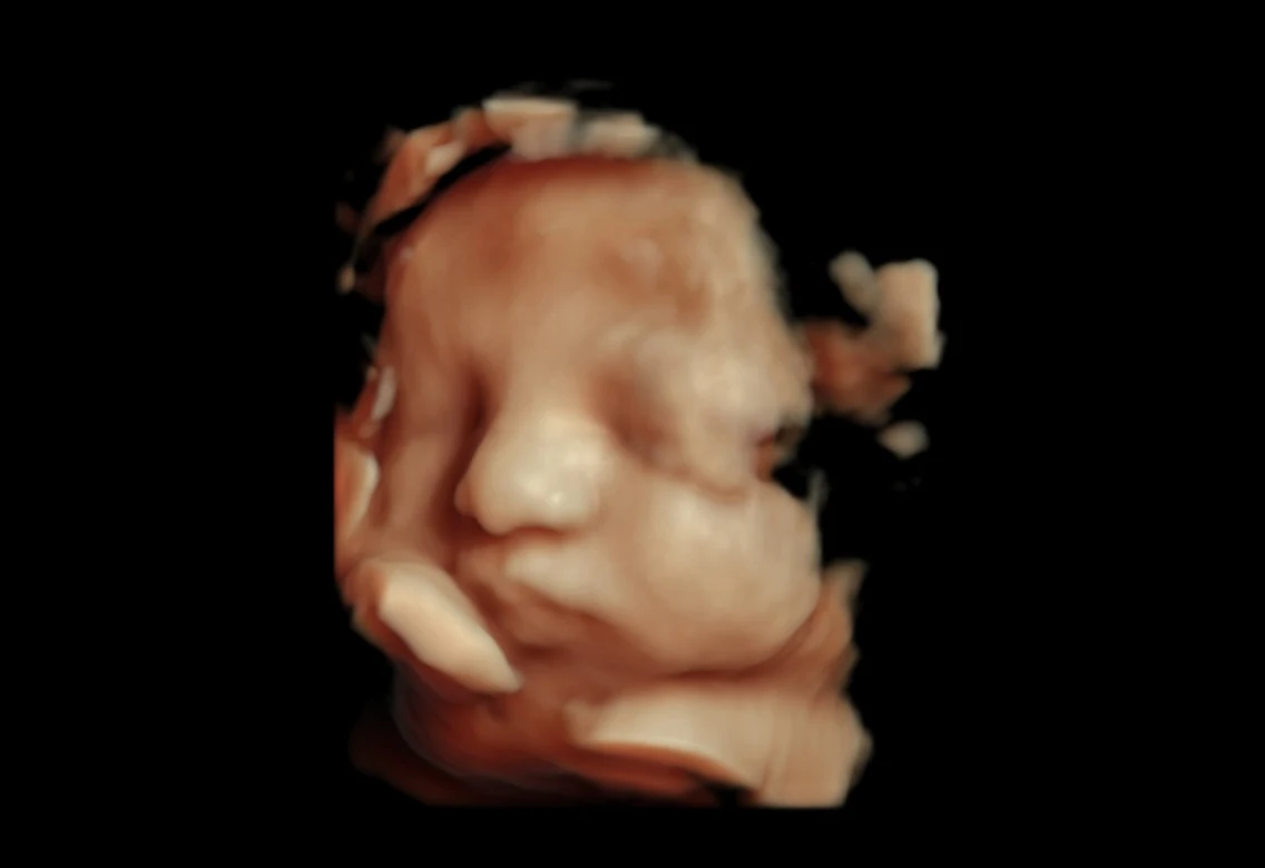 4D ultrasound view of a baby’s face turned toward a raised hand.